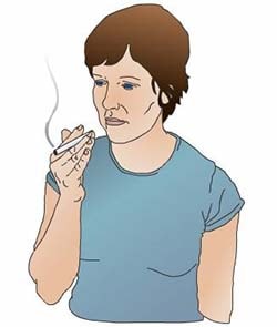 Sigara ve Kanseri Gelişimi (Kolon Kanseri)